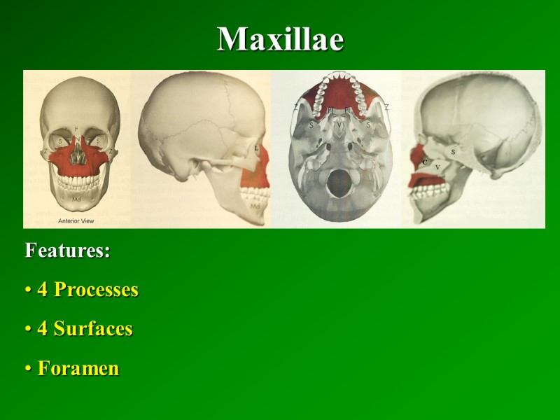 Maxillae   Features:  4 Processes  4 Surfaces  Foramen